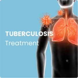 Tuberkulose-Behandlung