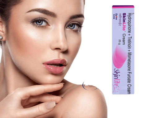 Skinlite Cream